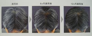 ヘアーサプライザーの実感.JPG